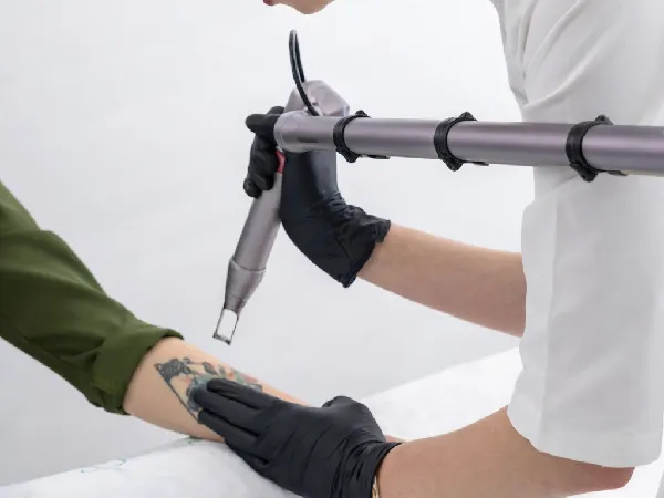 Laser Treatments in Al Falah Abu dhabi