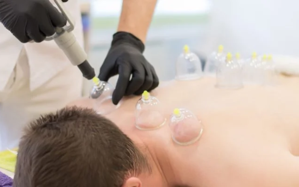 Hijama Therapy in Abu Dhabi | Traditional Cupping | Al Ibtikar