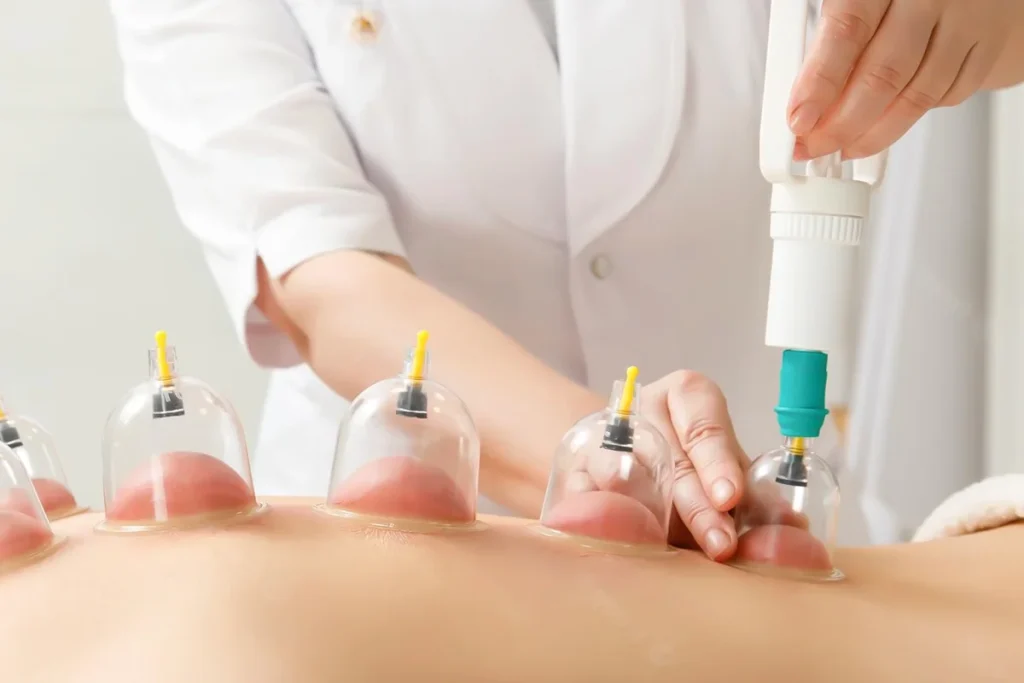 Physiotherapy Hijama: Integrated Care for Pain Relief, Mobility, and Wellness
